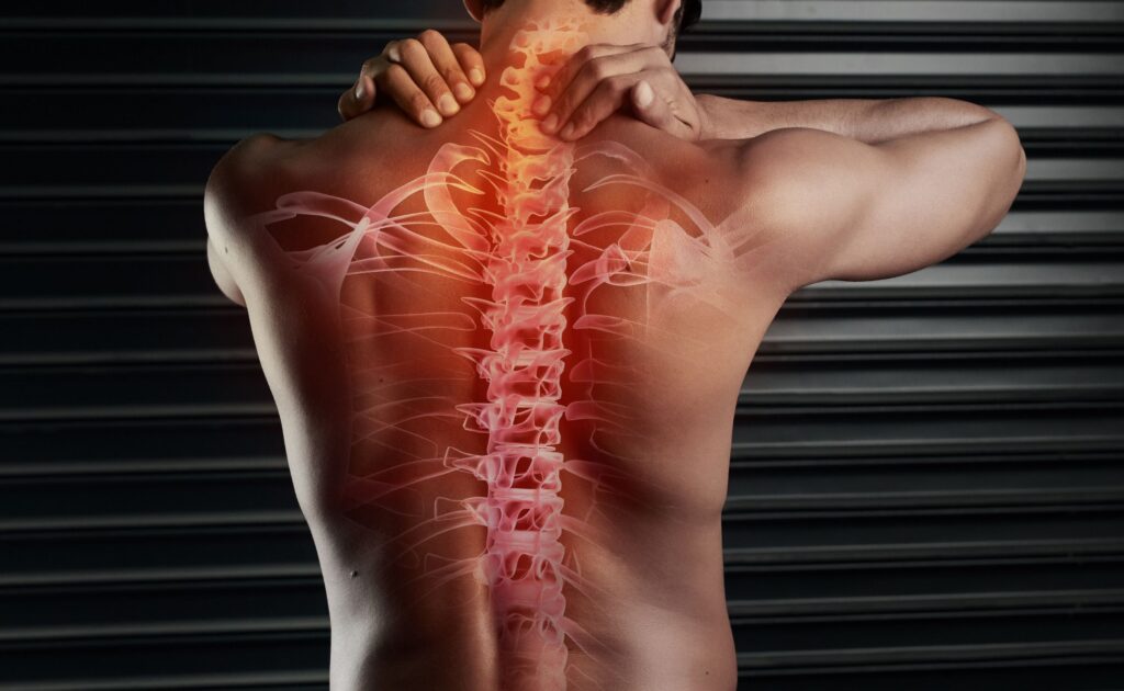 Back Problems